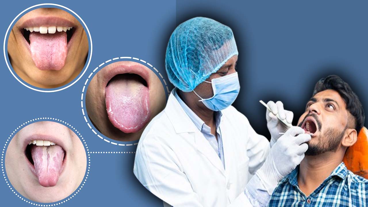 Tongue Colors: మీ నాలుక ఈ రంగుల్లో ఉంటే సంకేతం ఇదే..