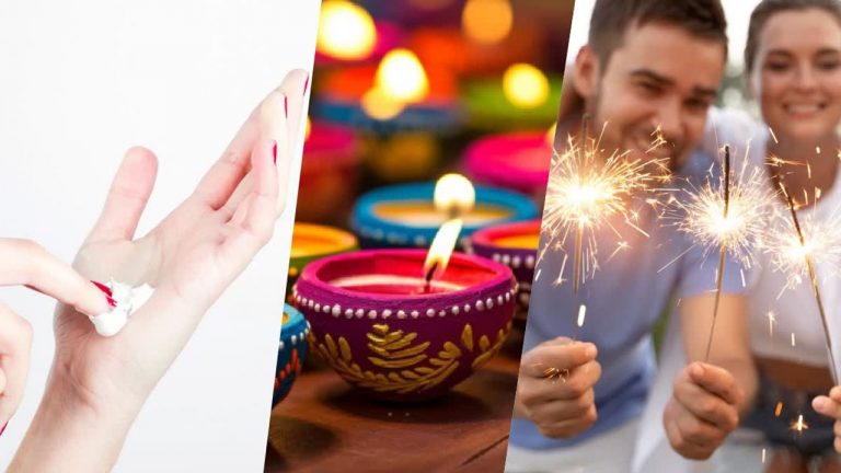 Burn Accident: టపాసుల వల్ల కాలిన గాయాలైతే.. ఈ వంటింటి చిట్కాలు పాటించండి