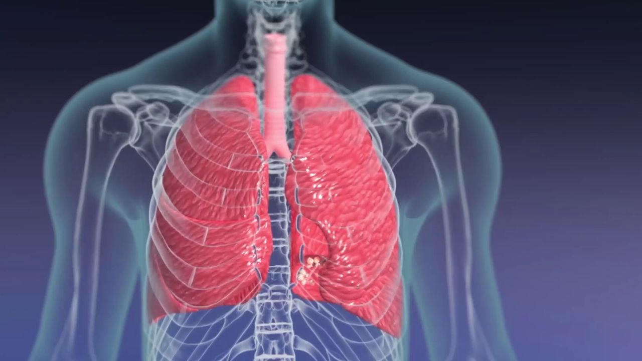 Health Tips: శీతాకాలంలో జలుబు ఊపిరితిత్తుల ఆరోగ్యాన్ని పాడు చేస్తుంది! ఈ టిప్స్‌ పాటించండి..