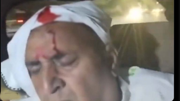 Maharashtra: ఎన్‌సీపీ నేత అనిల్ దేశ్‌ముఖ్ కారుపై రాళ్ల దాడి.. తలకు గాయాలు