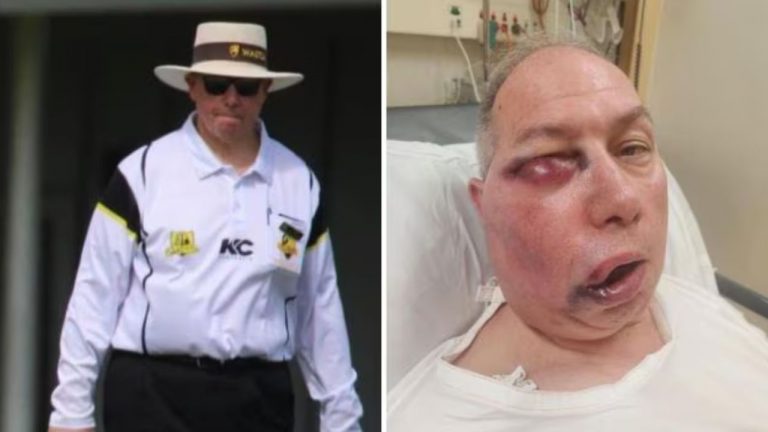 Umpire Injury: అయ్యో ఎంతపనాయె.. అంపైర్ కన్ను, మూతి పగిలిపోయాయిగా! పెర్త్ మైదానంలోనే