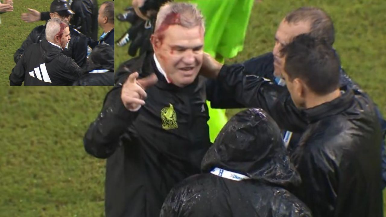 Javier Aguirre: బీర్ క్యాన్‌లతో కోచ్ పై దాడి.. తలపై రక్తస్రావం