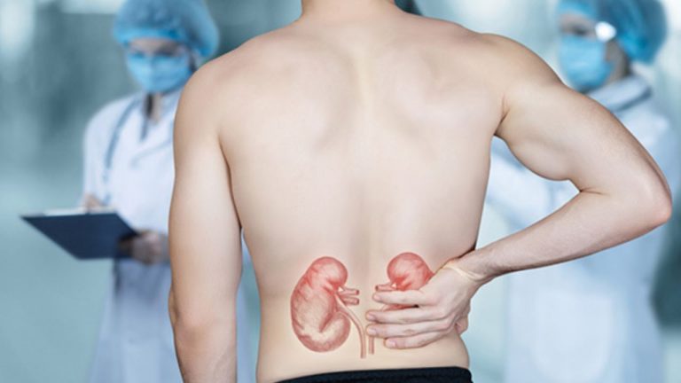 Kidney Cancer Signs: ఈ లక్షణాలు ఉంటే కిడ్నీ క్యాన్సర్‌ కావచ్చు