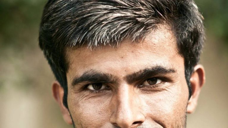 white hair : 30 ఏళ్ల వయసులోనే జుట్టు నెరిసిపోతుందా? కారణం ఏంటో తెలుసుకోండి ?