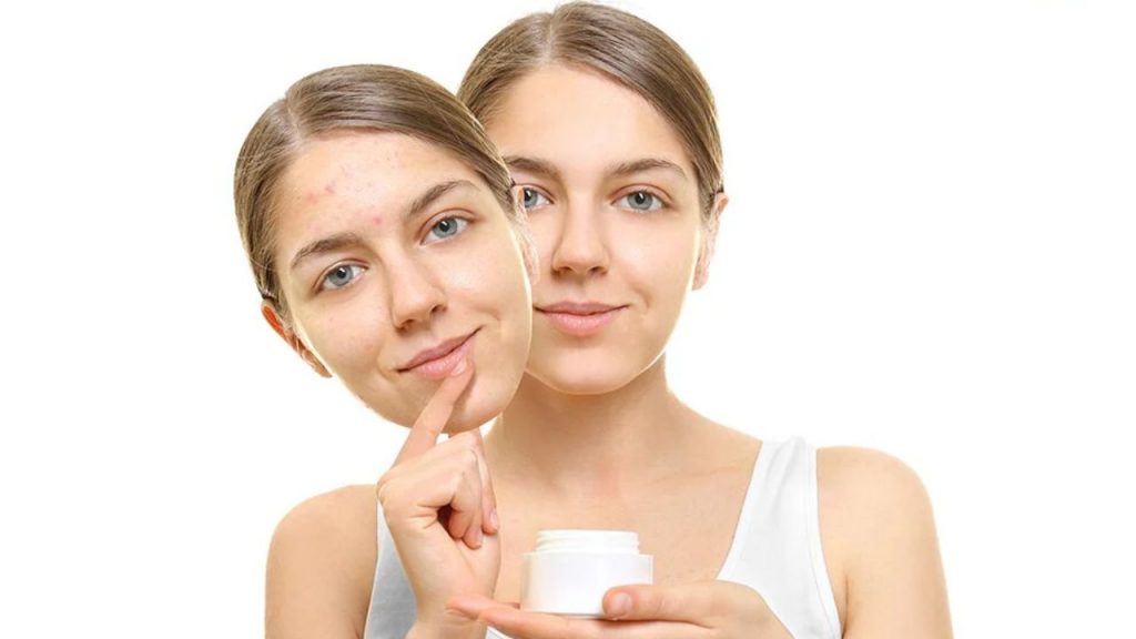 Spotless Face Tips