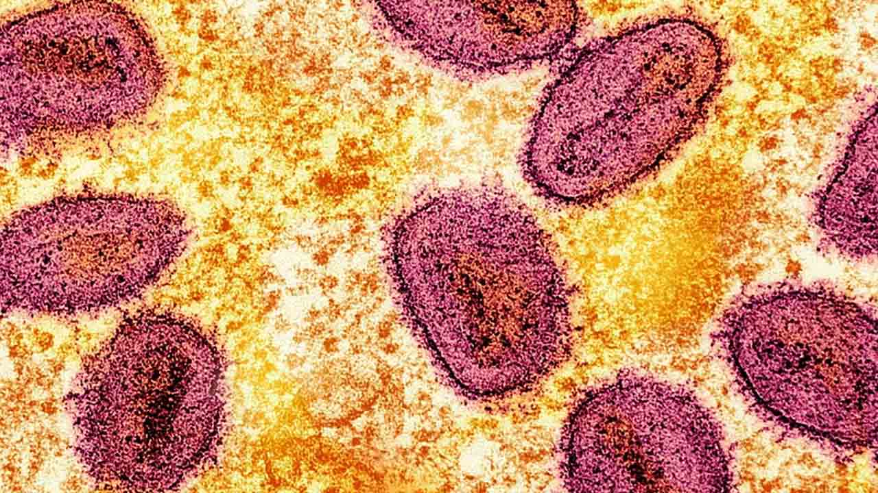 Bleeding Eye Virus: ప్రాణంతకంగా మారుతున్న ‘బ్లీడింగ్ ఐ వైరస్’.. లక్షణాలివే?