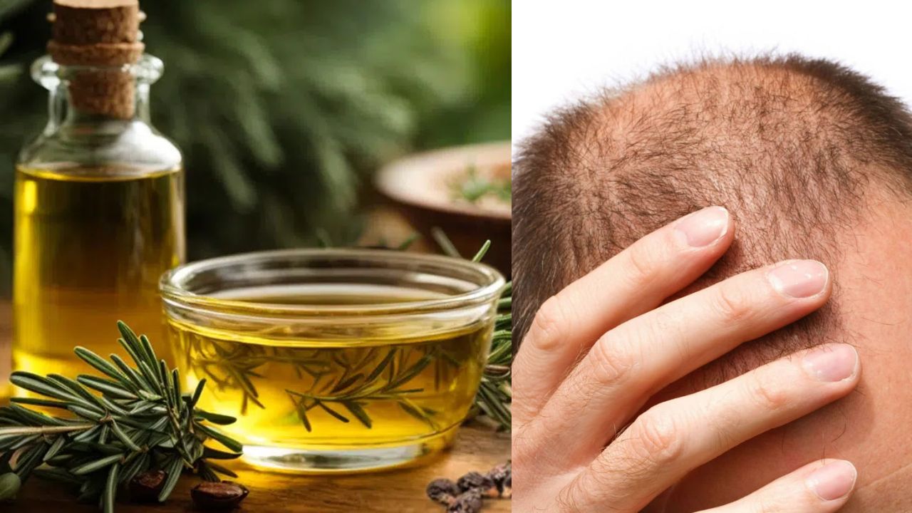 Bald Head Hair Oil: బట్టతలతో ఇబ్బందులా? ఈ నూనె 4 చుక్కలు వేసి ప్రతిరోజూ మసాజ్ చేస్తే చాలు