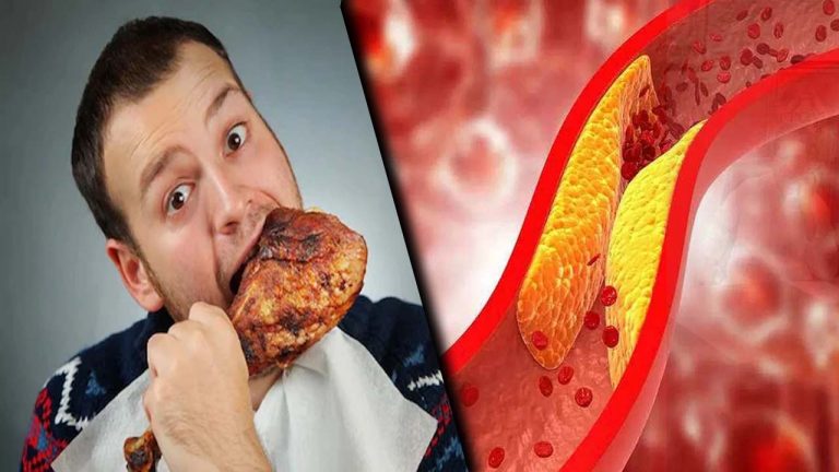 Health Tips: కొలెస్ట్రాల్ సమస్య.. నాన్ వెజ్ తినకూడదా?