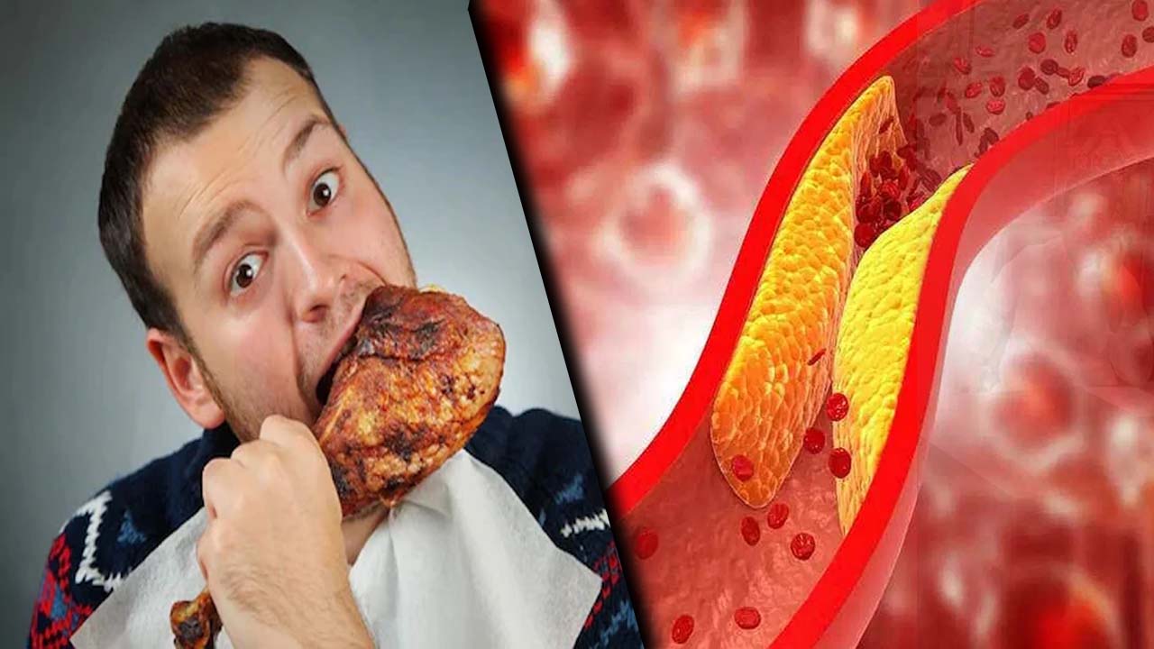 Health Tips: కొలెస్ట్రాల్ సమస్య.. నాన్ వెజ్ తినకూడదా?