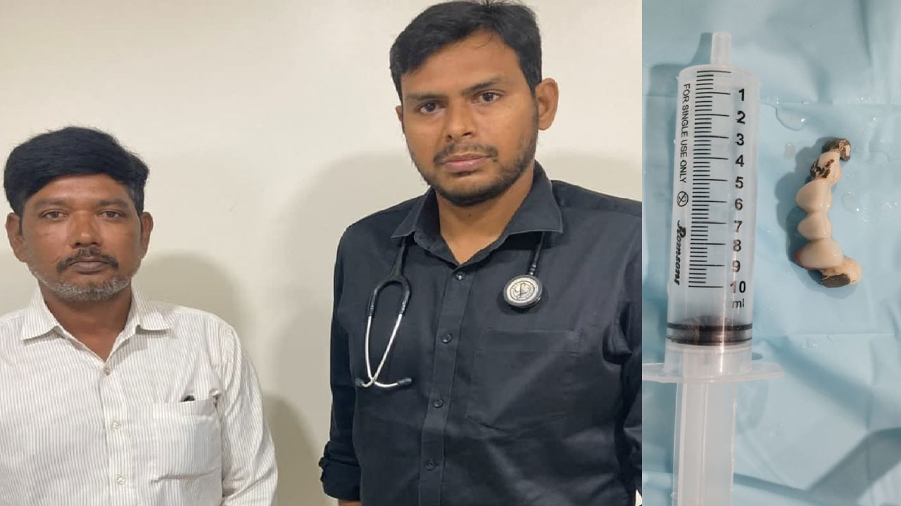 Swallows Set of Teeth : నిద్రలో ప‌ళ్ల సెట్ మింగేసిన వ్యక్తి.. ఆ తరువాత..!