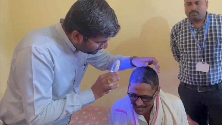 Bald Within A Week: మహారాష్ట్ర గ్రామాల్లో  “బట్టతల” భయం.. విపరీతంగా ఊడుతున్న ప్రజల జుట్టు..