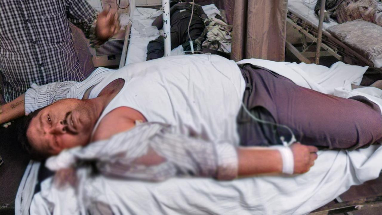 Tirupati: తిరుపతిలో మళ్లీ చిరుత కలకలం.. టీటీడీ ఉద్యోగిపై దాడి