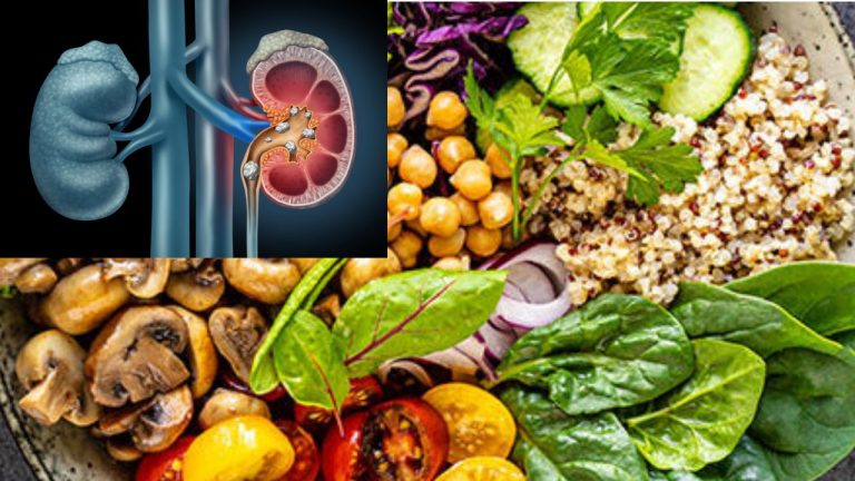 Kidney Stones: ఈ కూరగాయలను ఎక్కువగా తీస్తున్నారా? కిడ్నీలో రాళ్లు ఏర్పడవచ్చు జాగ్రత్త సుమీ