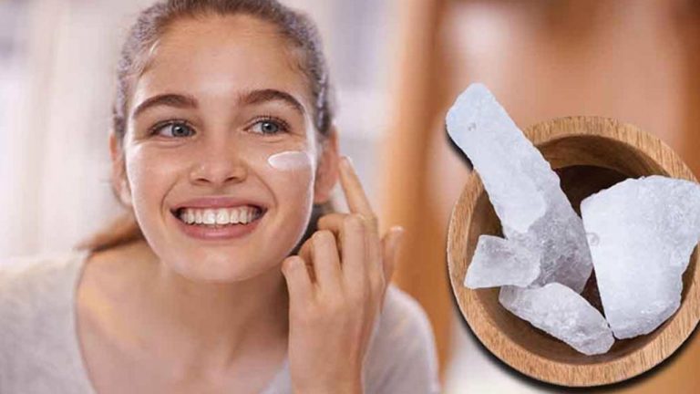 Beauty Tips: ముఖంపై మచ్చలు, మొటిమలతో ఇబ్బంది పడుతున్నారా..? ఇది ట్రై చేయండి