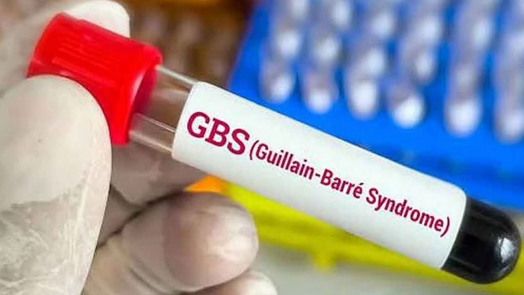 Gbs Outbreak