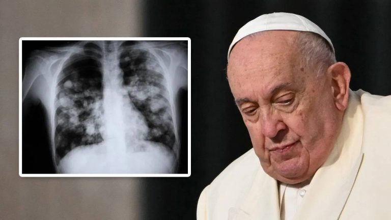 Pneumonia : ఆ వ్యాధితో బాధపడుతున్న పోప్.. దీని కారణంగా ప్రతేడాది ఎంతమంది చనిపోతున్నారో తెలుసా ?