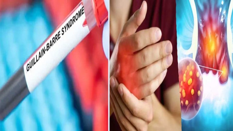 GBS Virus In AP: ఏపీలో జీపీఎస్ వైరస్ కేసులు నమోదు.. మంత్రి కీలక సూచనలు