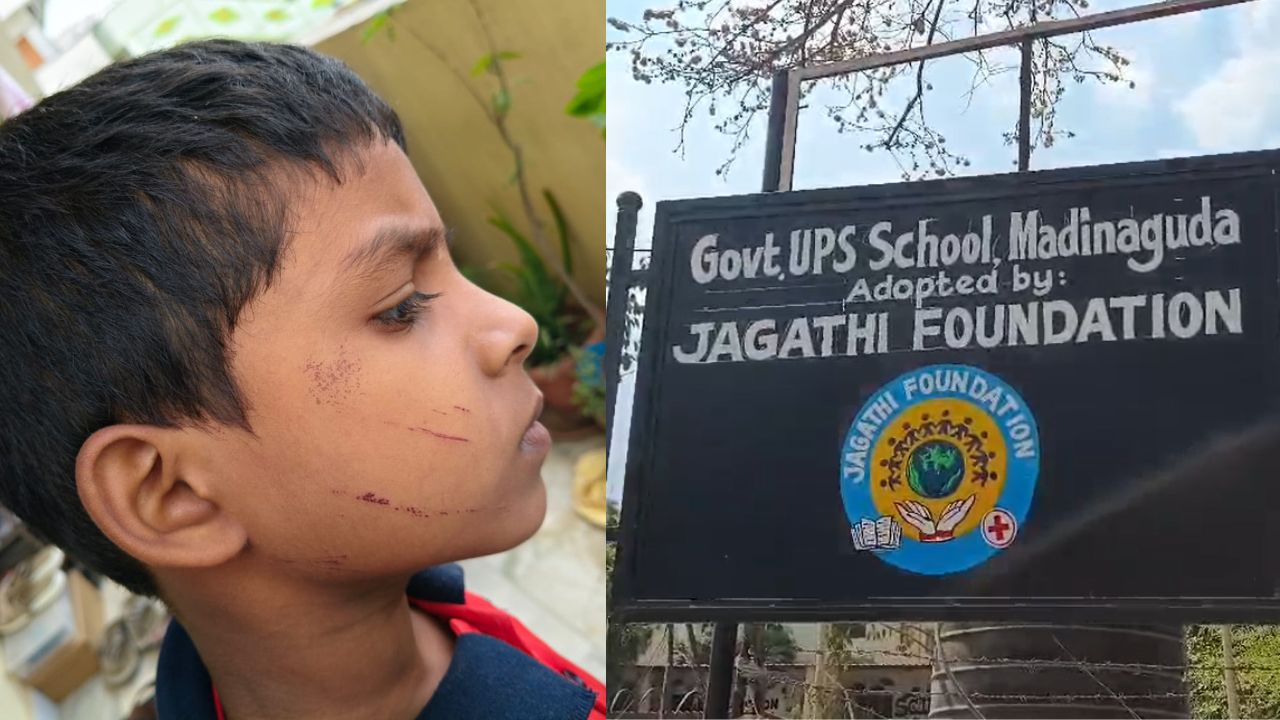 Teacher Harassment:  ప్రభుత్వ పాఠశాలలో విద్యార్థిపై ఉపాధ్యాయుడి దాడి..