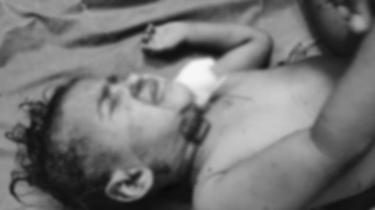 Hyderabad: అంబర్‌పేట్‌లో 19 నెలల చిన్నారిపై కుక్కల దాడి.. తీవ్ర గాయాలు