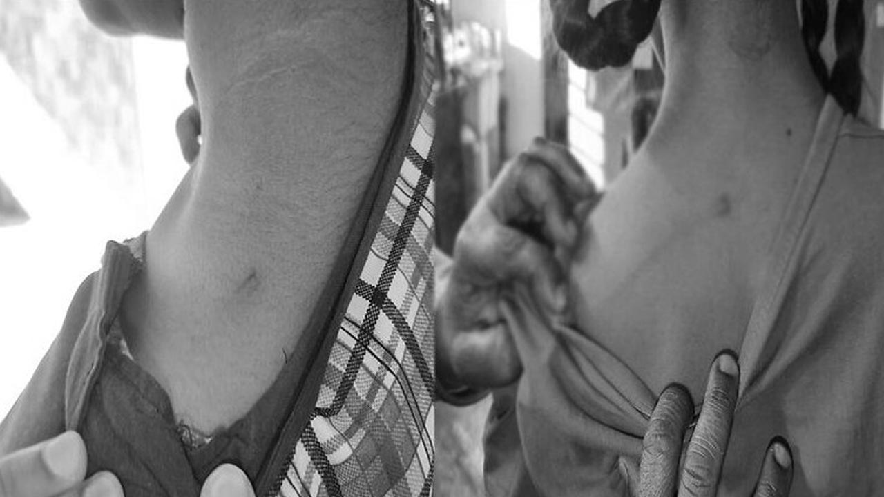 Keesara: విద్యార్థులను చితకబాదిన పీఈటీపై సస్పెన్షన్ వేటు..