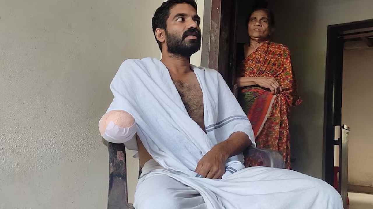 Fish bite: చేప కాటు వల్ల ప్రాణాంతక ఇన్ఫెక్షన్.. చేయిని కోల్పోయిన రైతు..