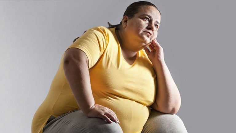 Obesity Causes: అతిగా తినడం మాత్రమే కాదు.. ఈ తప్పులు కూడా ఊబకాయానికి కారణాలే
