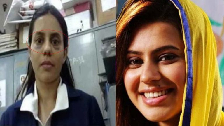 Ranya Rao: రన్యారావు గాయాలపై డీఆర్‌ఐ కీలక ప్రకటన