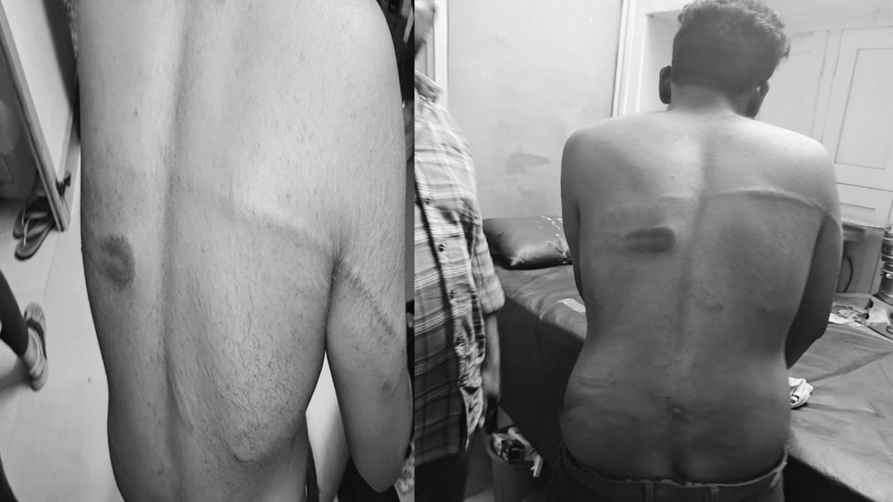 Hanamkonda: ముస్లిం అమ్మాయితో మాట్లాడిన హిందూ యువకుడిపై దాడి..