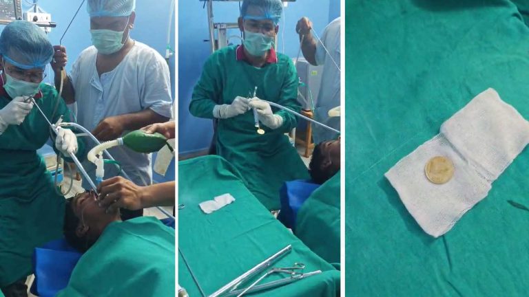 Boy Swallowed Five Rupee Coin: రూ.5 బిల్ల మింగిన బాలుడు.. అన్నవాహికలో ఇరుక్కుపోవడంతో..