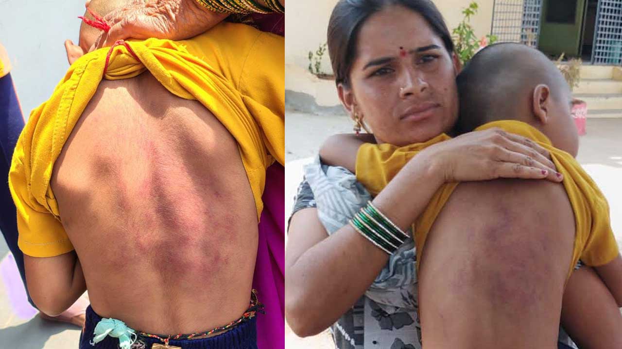 Violence : బాలుడిపై ఉపాధ్యాయుడి దౌర్జన్యం.. 1వ తరగతి విద్యార్థిని తీవ్రంగా కొట్టిన టీచర్‌