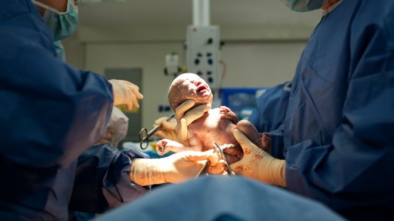 Normal Delivery: నార్మల్ డెలివరీ కావాలంటే ఈ చిట్కాలు పాటిస్తే సరి!