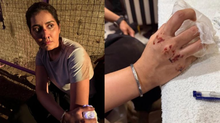 Raashi Khanna : షూటింగ్‌‌లో గాయపడ్డ హీరోయిన్..