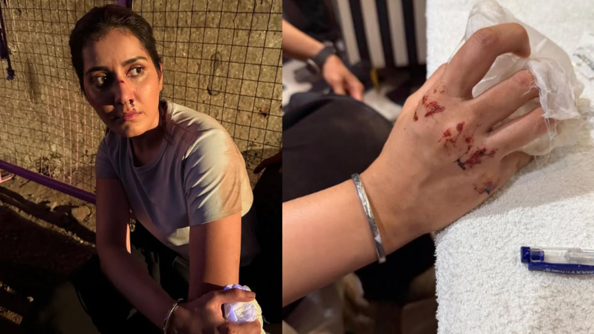 Raashi Khanna : షూటింగ్‌‌లో గాయపడ్డ హీరోయిన్..