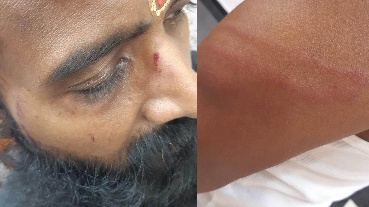 Veera Raghava Reddy Attacked Once more Close to Moyinabad | Ramarajyam Military Controversy Deepens Veera Raghava Reddy Attacked Once more Close to Moyinabad | Ramarajyam Military Controversy Deepens