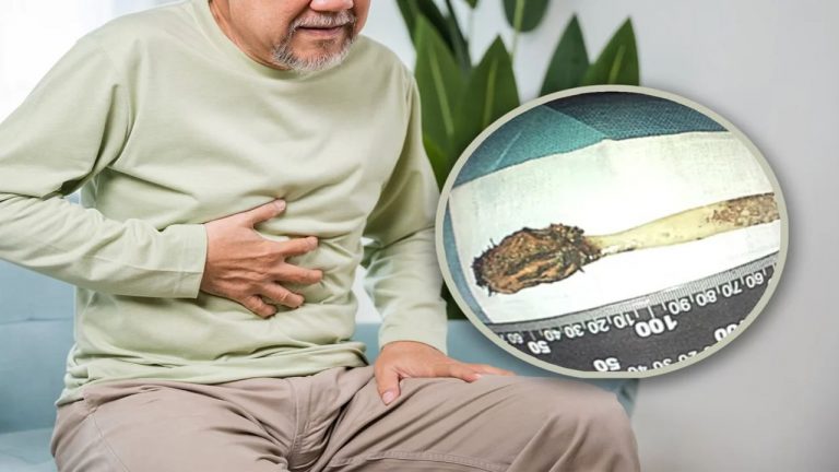 China: 52 ఏళ్లుగా కడుపులోనే టూత్‌బ్రేస్.. ఎలా బయటపడిందంటే..?