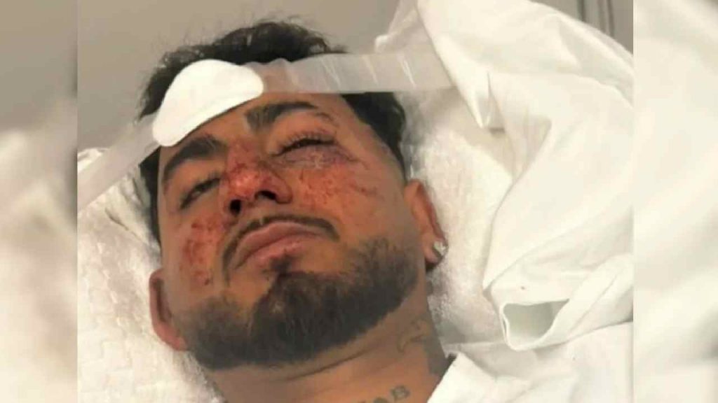 Racially Abused In Australia