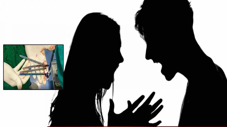 Woman Swallows Pens: ఇదేందయ్యా ఇది..! భర్త మీద కోపంతో పెన్నులు మిగింది.. చివరకు..!