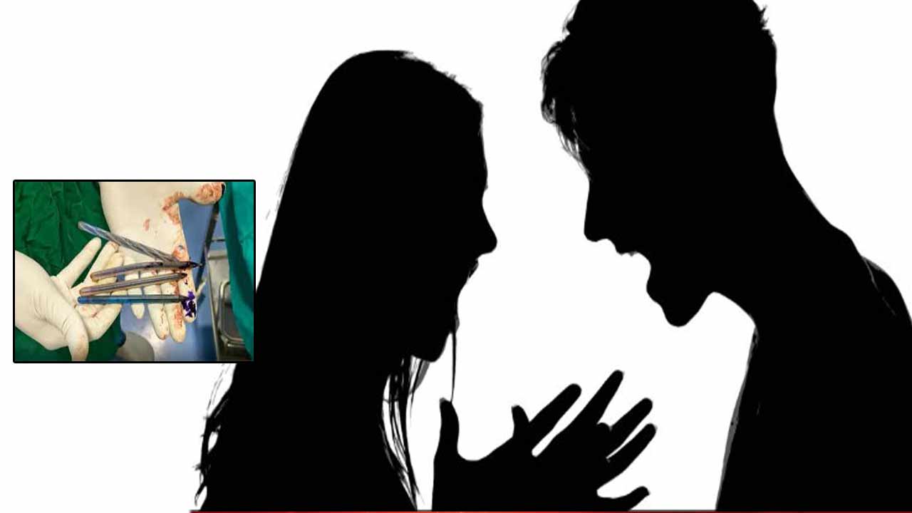 Woman Swallows Pens: ఇదేందయ్యా ఇది..! భర్త మీద కోపంతో పెన్నులు మిగింది.. చివరకు..!