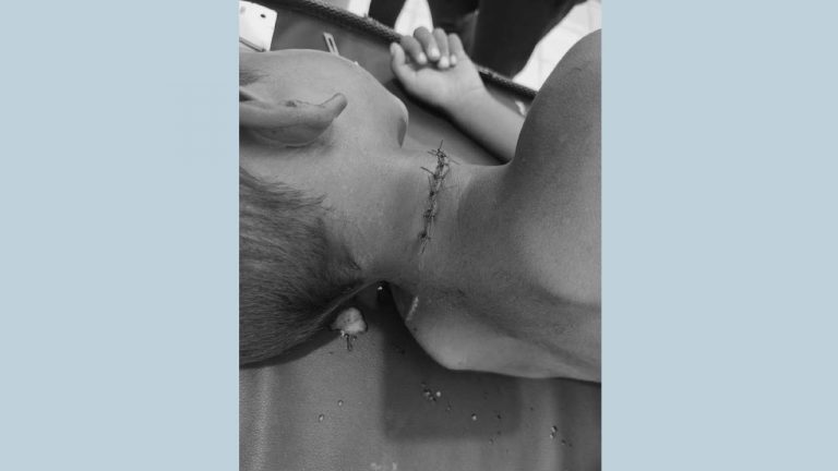 Mahabubabad: ఇంట్లో నిద్రిస్తున్న 6 ఏళ్ల బాలుడిపై కత్తితో దాడి.. తీవ్ర గాయాలు