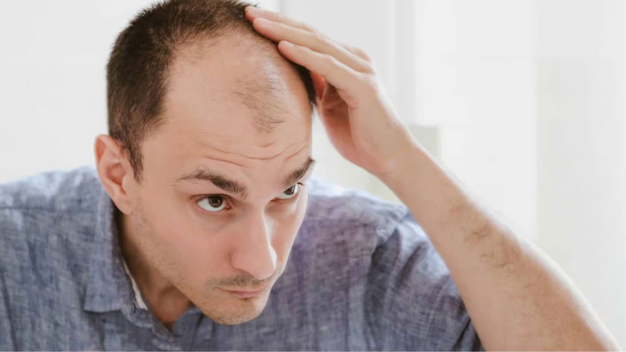 Children Baldness: వారసత్వ బట్టతలపై మీకు తెలియని నిజాలు!