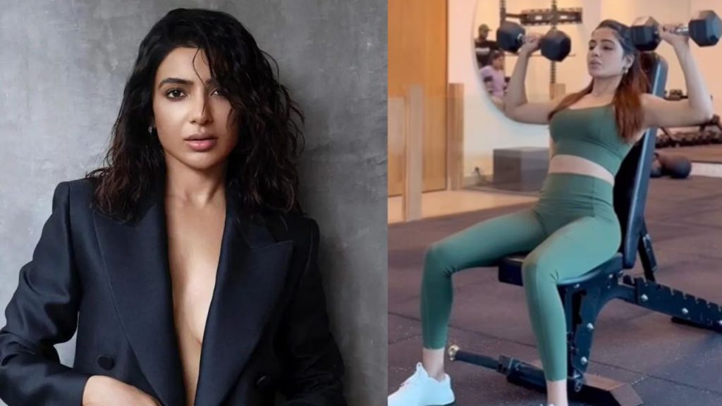 Shah Rukh Khan Injury