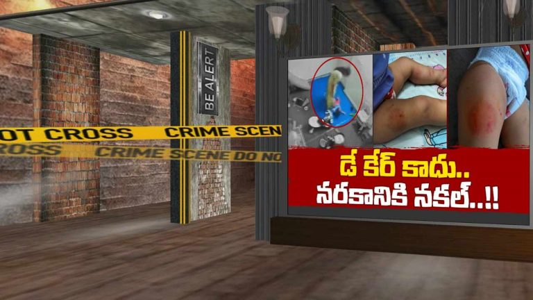 Day Care : చిన్నారి శరీరంపై గాయాలు.. డే కేర్ సిబ్బంది వీడియోలు వెలుగులోకి..