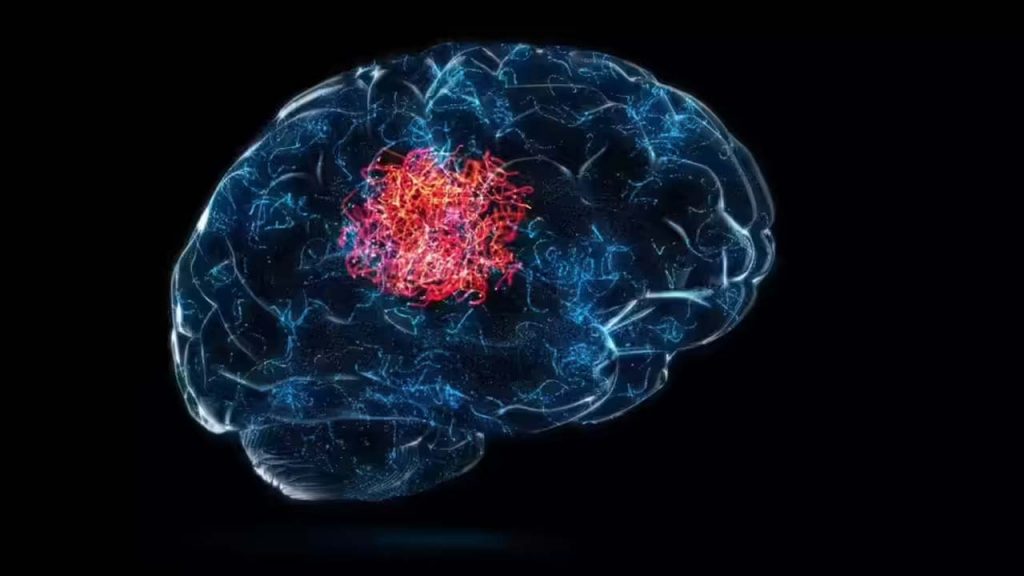 Micro Pralstic In Brain