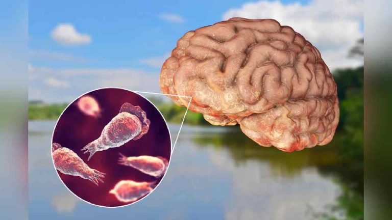 Brain-Eating Amoeba: ‘‘మెదడు తినే అమీబా’’ కేరళలో 19 మందిని చంపేసింది.. ఇది ఎలా వ్యాపిస్తుంది, అడ్డుకోవడం ఎలా..?