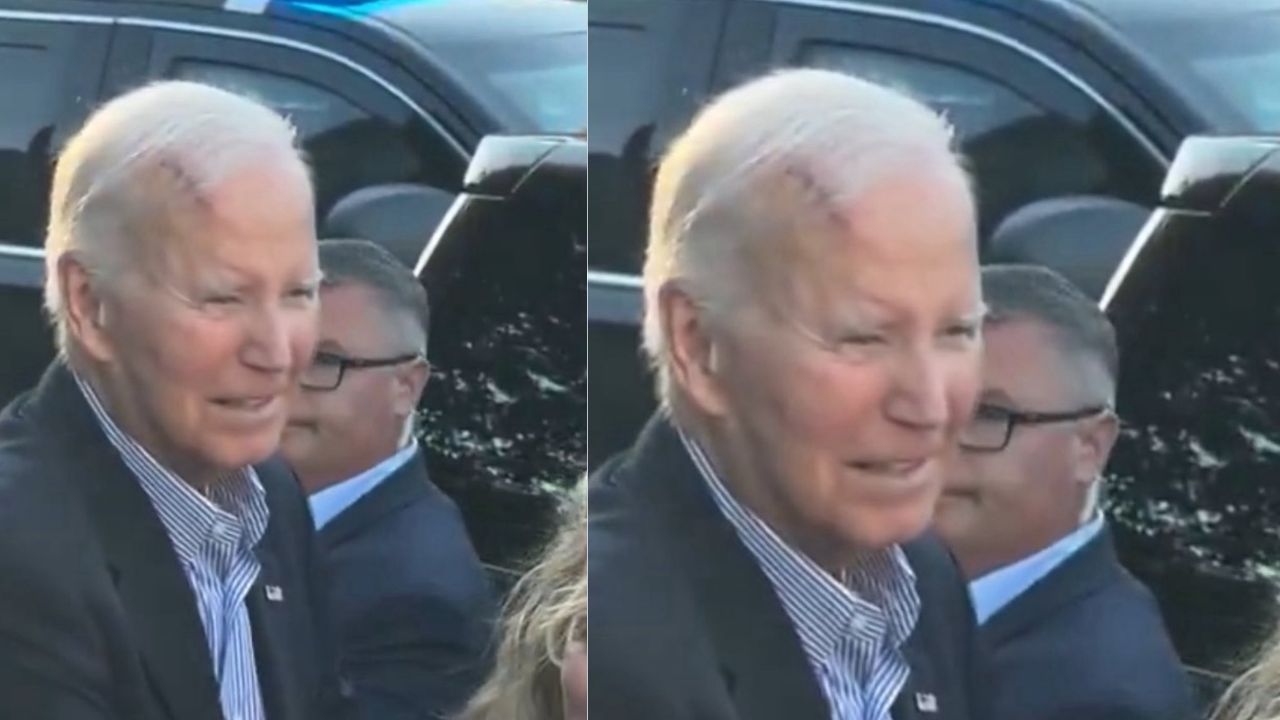 Joe Biden: మాజీ అమెరికా అధ్యక్షుడుకు ఏమైంది? తలపై ఆ గాయమేంటి?