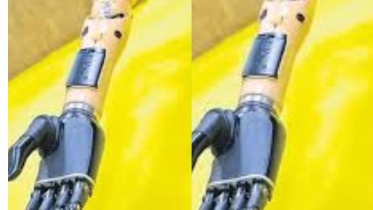 Vizag: దివ్యాంగులకు కృత్రిమ చేతుల తయారీ