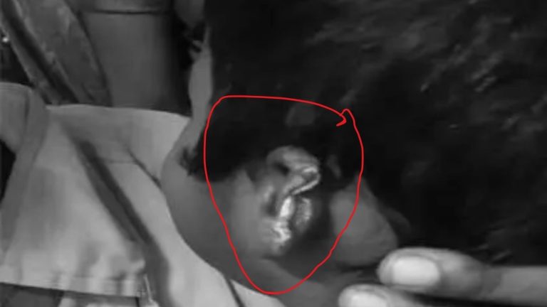 Mahabubabad:  దారుణం.. ఆరేళ్ల చిన్నారిపై   పిచ్చికుక్క దాడి.. తెగిపోయిన చెవి