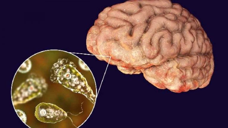 Brain Infection: కేరళను భయపెడుతున్న అరుదైన ‘‘బ్రెయిన్ ఇన్ఫెక్షన్’’.. మరో ఇద్దరు మృతి..