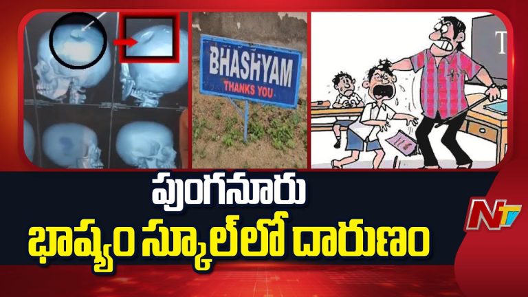 Chittoor : చిత్తూరు పాఠశాలలో దారుణం..టీచర్ బ్యాగ్‌తో కొట్టడంతో విద్యార్థి పరిస్థితి విషమం