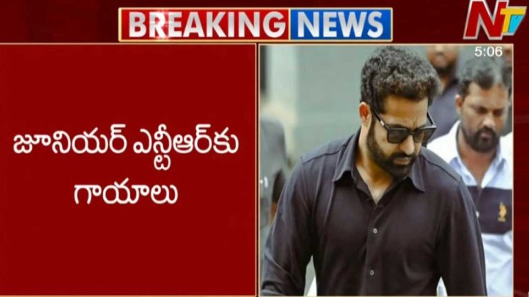 Jr NTR Injured: ఎన్టీఆర్‌కు గాయాలు.. షాక్ లో ఫాన్స్!